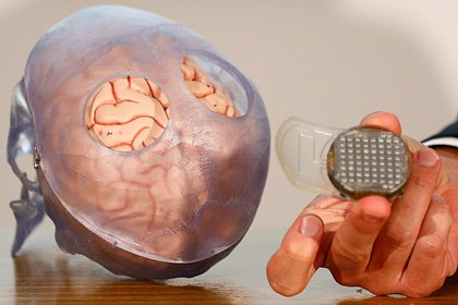 raskryt glavnyy vred ot mozgovyh implantov