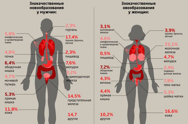 Быть или не быть? Известный специалист рассказал об онкологии без утайки