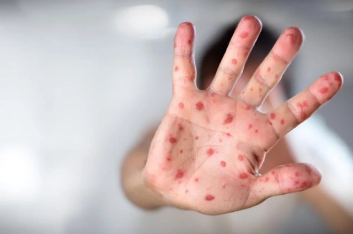 опасно Эксперт пояснил болеют ли взрослые детскими инфекциями