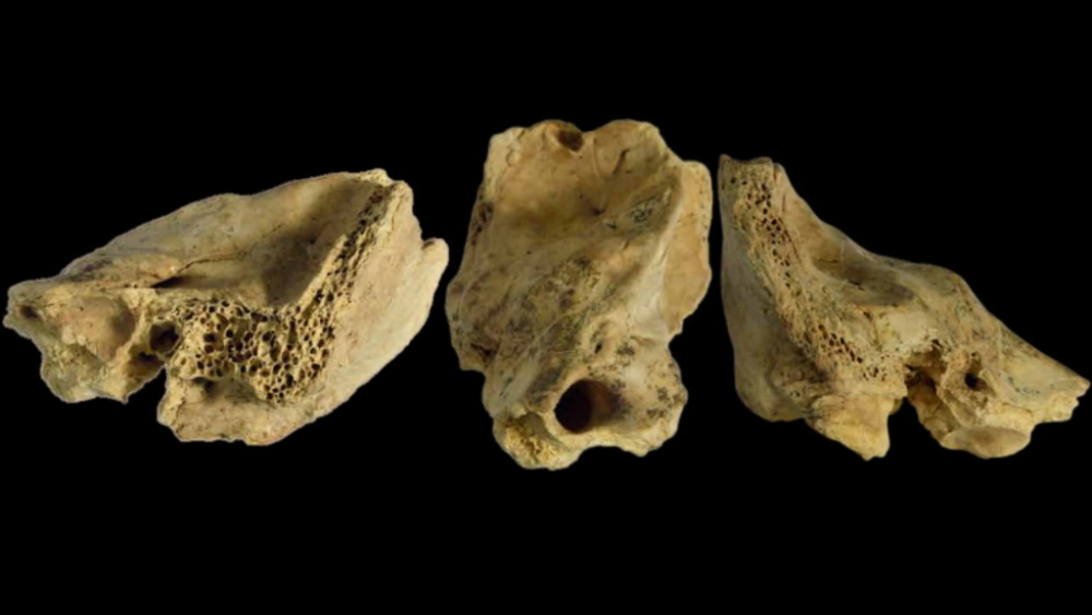 кость неандертальца который жил с синдромом Дауна